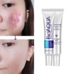 Acne Scar Removal Rejuvenation Cream